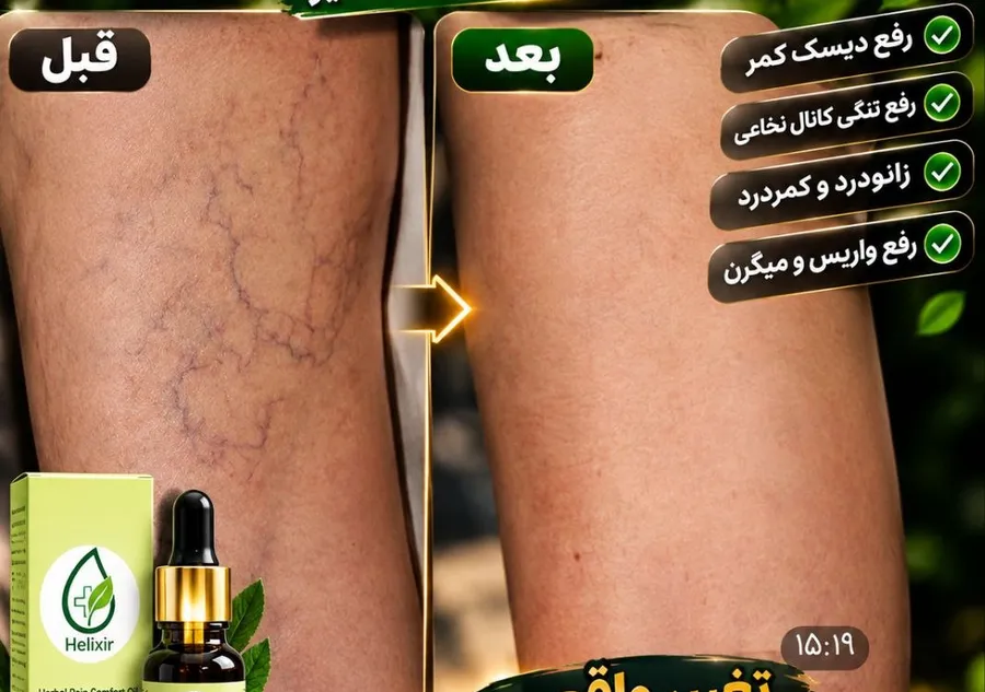 قبل و بعد استفاده از روغن هلکسیر